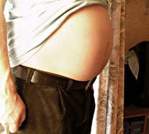 overweight person overweight person